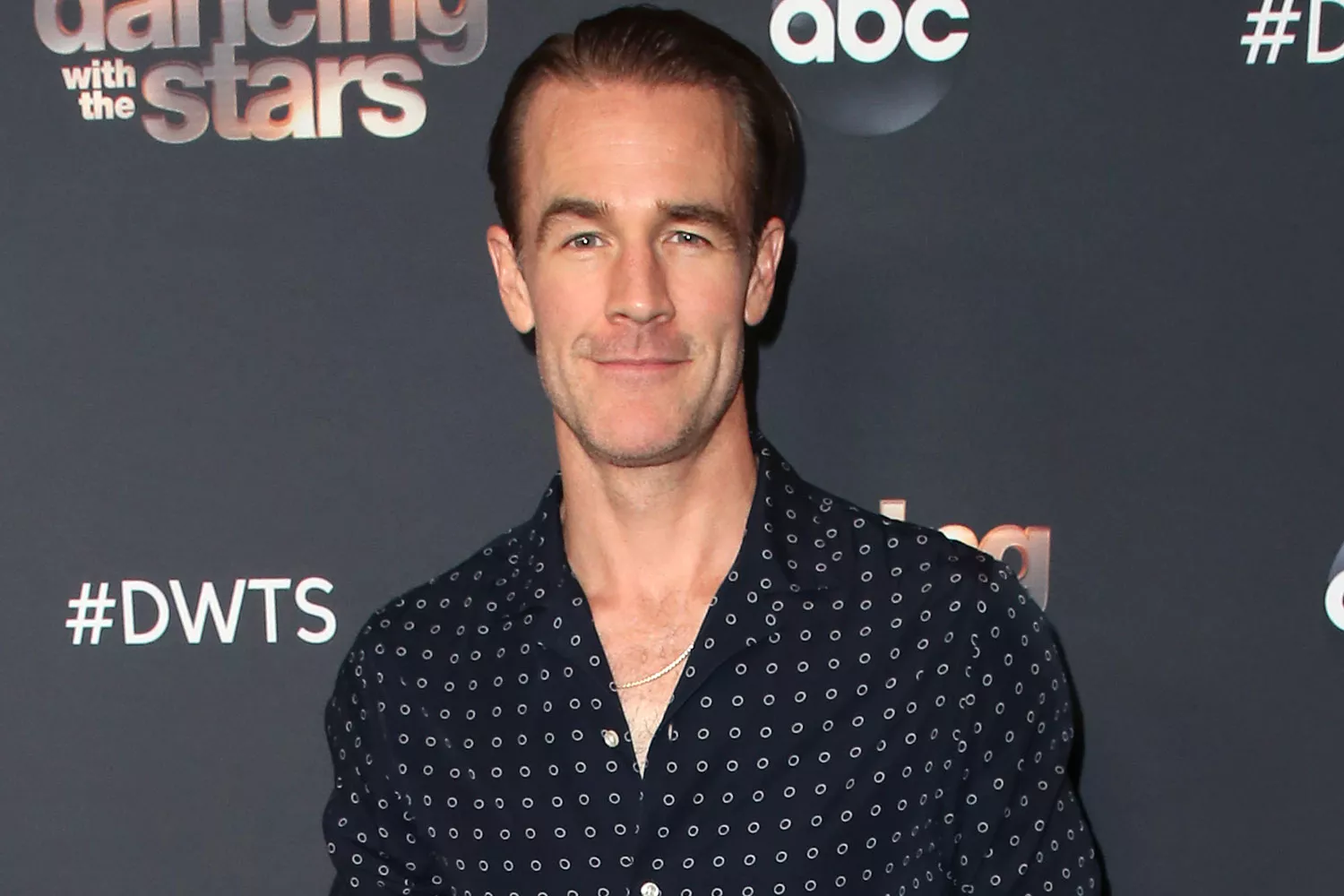 James Van Der Beek Reveals Colorectal Cancer Diagnosis: 'There's Reason for Optimism'